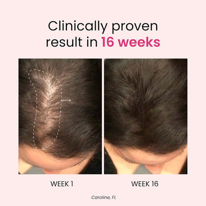 Trybello Anagain™ Hair Growth & Anti-Stress Gummies 3 bottles